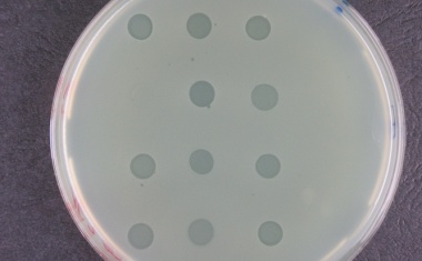 Viren, die Krankheiten bekämpfen können: Bakteriophagen