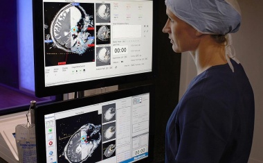 Laserthermoablationstechnologie am Universitätsklinikum Frankfurt