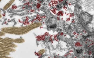 Wie SARS-CoV-2 in das Gehirn gelangt