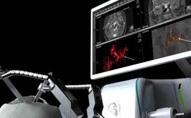 4D-Simulation bringt Durchbruch bei Hirnoperation