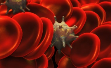 Antikörper gegen Blutplättchen fördern Thrombosen bei COVID-19 Infektionen