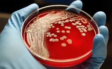 Hoffnung auf Impfung gegen Staphylococcus aureus-Infektionen?