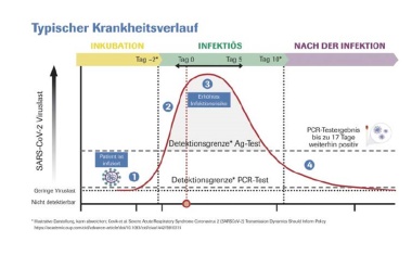 Diagnostik der Infektionskrankheit COVID-19
