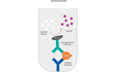 Antigen-Tests – Labor-basiert oder als POCT