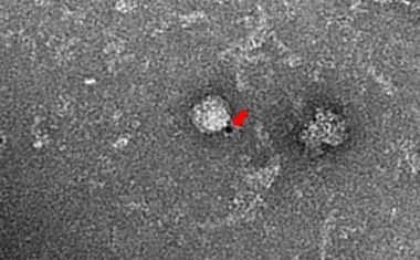 Hepatitis-E-Viren überleben im Ejakulat chronisch-infizierter Patienten