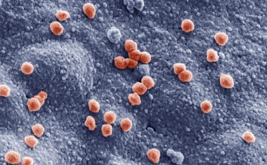 COVID-19-Atlas der Gewebeschäden und Viruslast in Organen