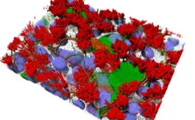 Individuelle SARS-CoV-2-Infektion