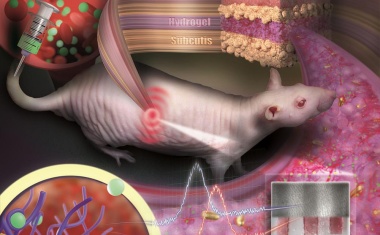 Tattoo aus Goldnanopartikeln revolutioniert medizinische Diagnostik