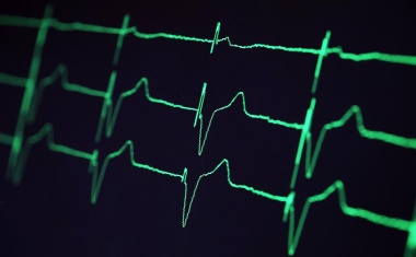 Helios baut klinisches Register für Herzinsuffizienz auf