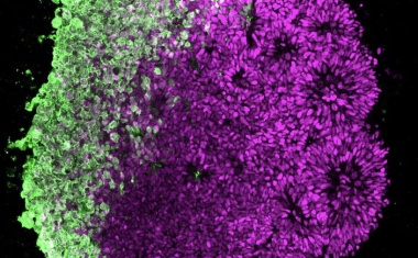 Wie Viren das wachsende Gehirn schädigen