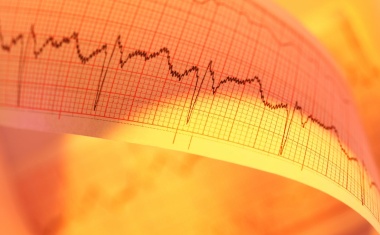 Verengte untere Hohlvene schwächt das Herz