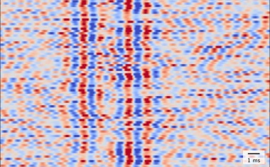 Charité gelingt magnetischer Blick durch die Schädeldecke