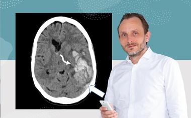 Neue Erkenntnisse zu seltenen Nebenwirkungen nach Corona-Impfung