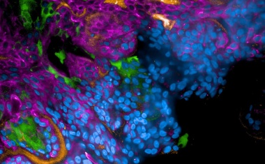 COVID-19: Humanes 3D-Modell enthüllt neues Angriffsziel zur Verhinderung schwerer Verläufe