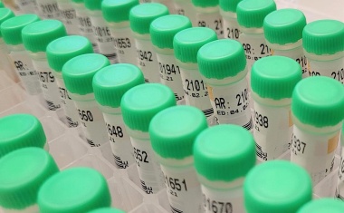 SARS-CoV-2: Charité untersucht, welche Personengruppen potenziell am ansteckendsten sind