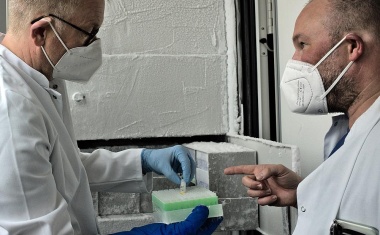 Uniklinikum Würzburg: Potenzieller Ansatzpunkt für eine Sepsis-Früherkennung entdeckt