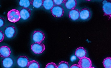 Antikörper bleiben auch bei Älteren lern- und abwehrfähig