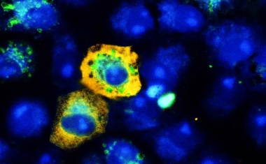 Charité prüft den Einsatz von Bandwurmmittel gegen SARS-CoV-2