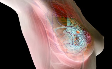 Neue Methode zur Vorhersage des Erfolgs einer Brustkrebstherapie gibt mehr Sicherheit
