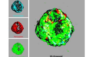Schlaganfallforschung ohne Tierversuche: „Mini-brains“ statt Mausmodell