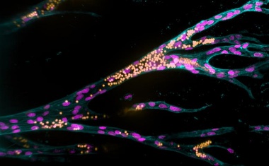 Erstes künstliches Gewebemodell entwickelt, in dem Blutgefäße wachsen