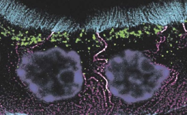 Im Focus: STED-Mikroskop