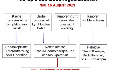 Studie zur Behandlung von Speisenröhrenkrebs gibt Anlass zur Hoffnung