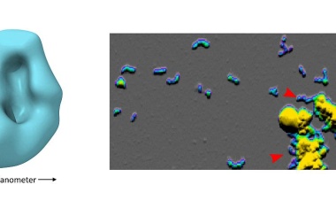 Alzheimerforschung: Neue Erkenntnisse zur Bildung schädlicher Proteinklümpchen