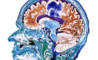 Künstliche Intelligenz entschlüsselt neuronalen Code