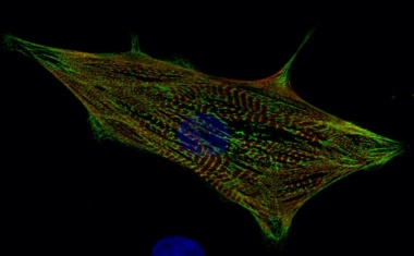 Ein Zellatlas für Kinderherzen
