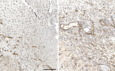 Natürliche Killerzellen steuern die Wundheilung