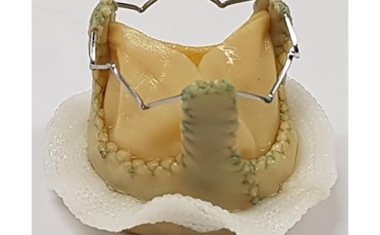 Verkalkung von biologischen Herzklappenprothesen verhindern