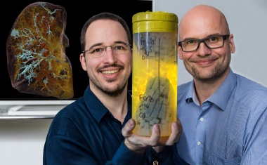 Neue Röntgentechnik zeigt erstmals Gefäßschäden in intakter COVID-19-Lunge