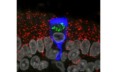 Sars-CoV-2 infiziert Stützzellen im Riechepithel von Covid-19-Patienten