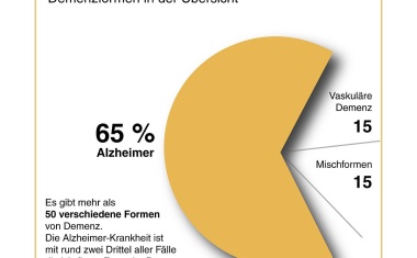Alzheimer Forschung Initiative schreibt Fördermittel aus