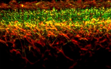 Innovationspreis der Europäischen Kommission für optoakustische Bildgebung