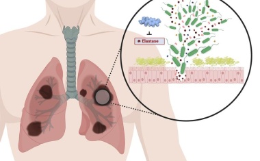 Waffenruhe für resistente Keime