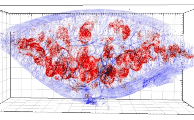 Verborgener Feind: Krankheitserreger verstecken sich im Gewebe