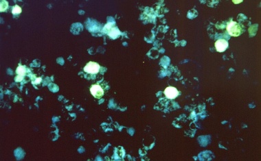 DZIF und Helmholtz Munich entwickeln einen Impfstoff gegen das Epstein-Barr-Virus