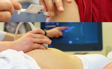 Auch Schwangere sollten sich gegen Covid impfen lassen