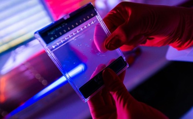 Genetischer Risikofaktor für Covid-19 schützt vor HIV