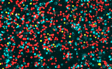 Immun-Check für die Lunge