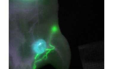 Durchbruch bei Farbstoffentwicklung für die fluoreszenzgeführte Krebschirurgie