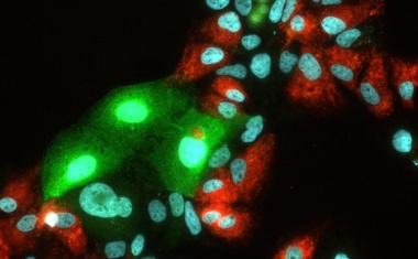 Ich war zuerst da! Wie Heptitis C Hepatitis E hemmt