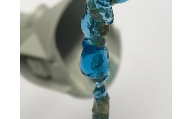 Nierensteinfragmente mit Hydrogel entfernen