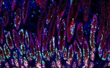 Magenentzündungen: wie eine bakterielle Infektion das Gewebe verändert