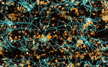 Pilzinfektionen in der Lunge