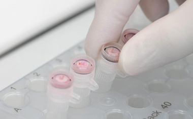 ERC Advanced Grant für Ulmer Virologen Prof. Frank Kirchhoff