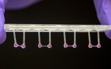 ERC Advanced Grant für Herzforschung am MDC