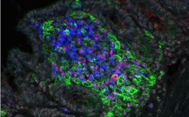 ERC Advanced Grants für Spitzenforschende der Charité